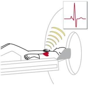 Anwendung von Easy-Trigger bei einem Erwachsenen
